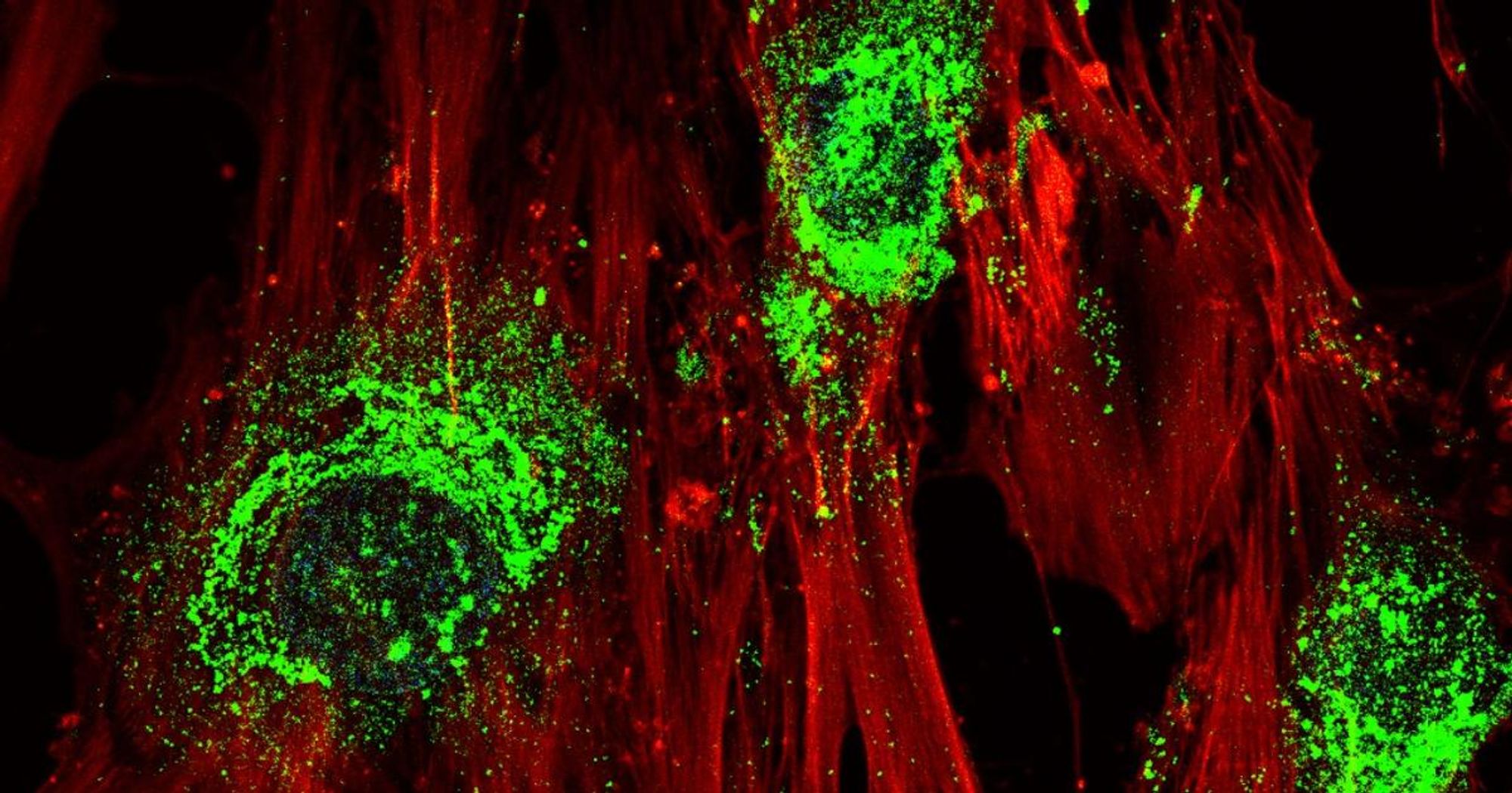 Sound waves convert stem cells into bone in regenerative breakthrough