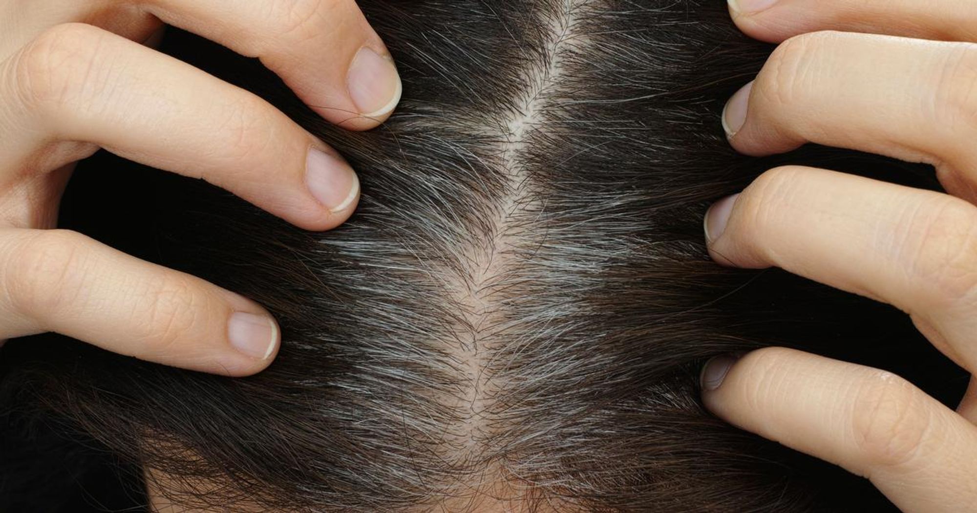 Stress study shows graying hair is reversible