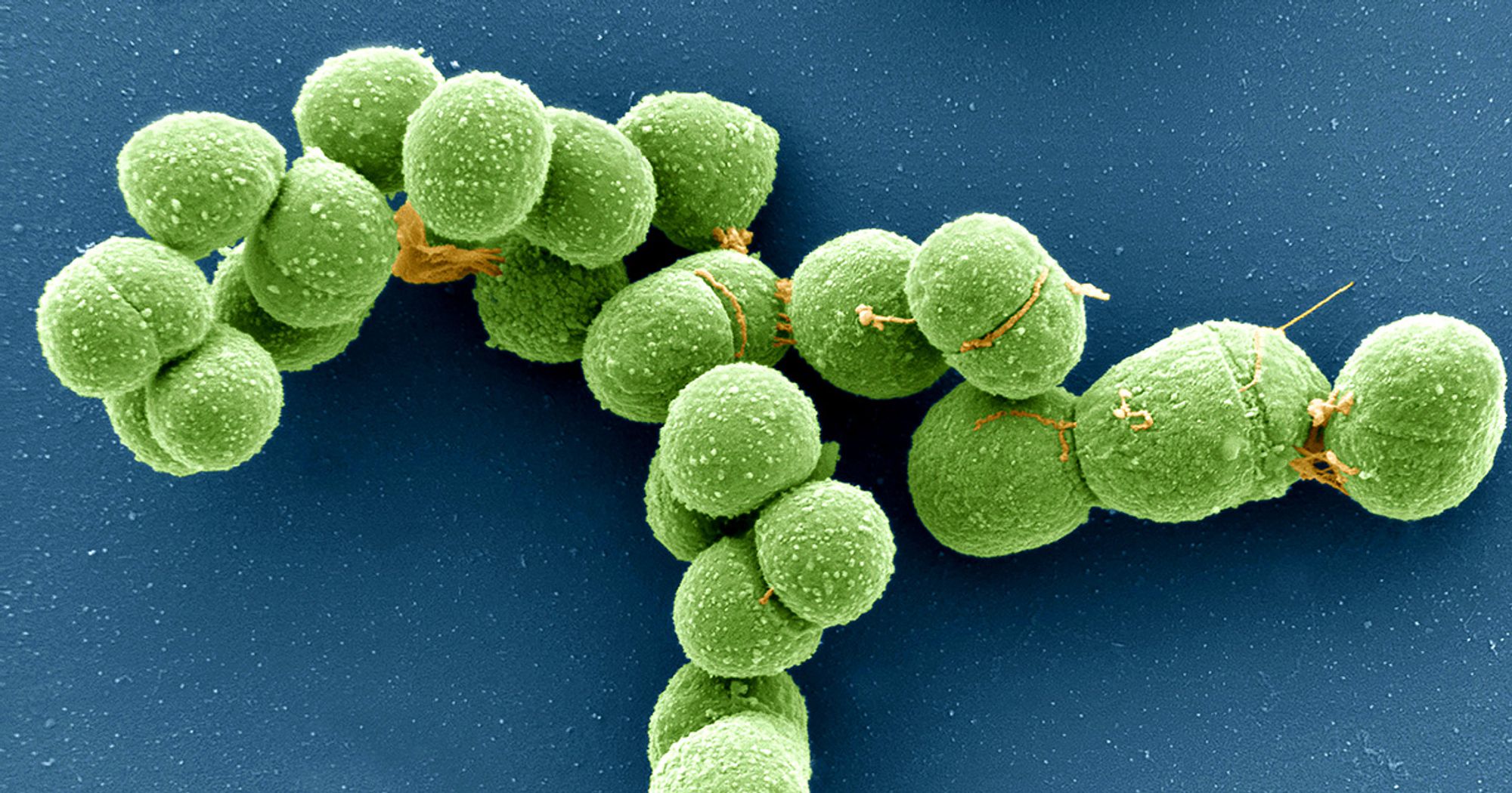 Plasmid, Virus or Other? DNA 'Borgs' Blur Boundaries. | Quanta Magazine