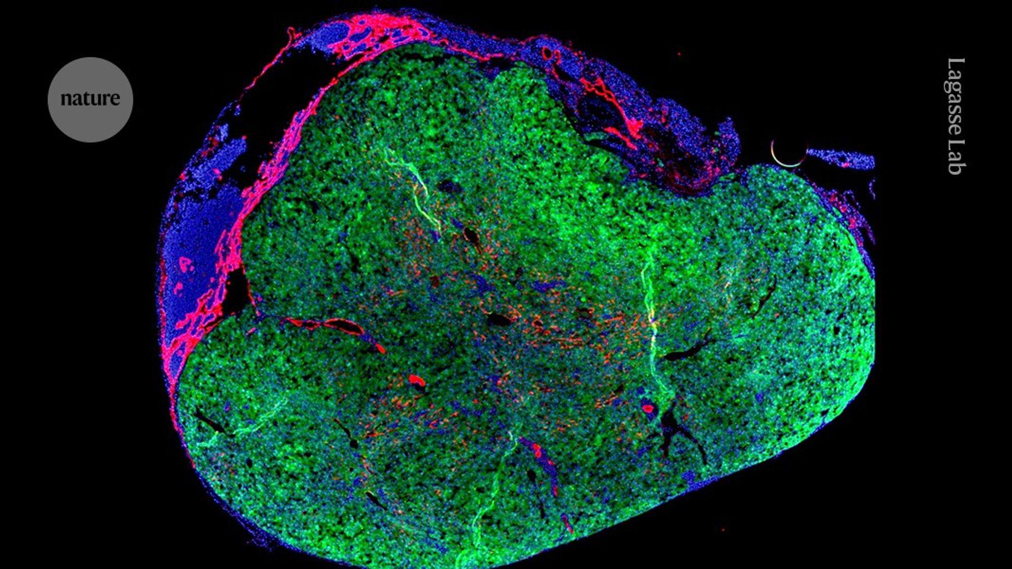 ‘Mini liver’ will grow in person’s own lymph node in bold new trial