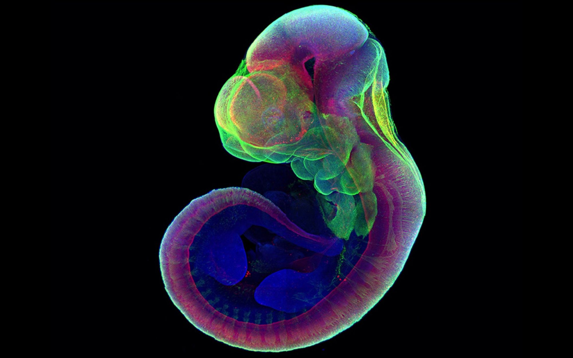 This mouse embryo grew in an artificial uterus