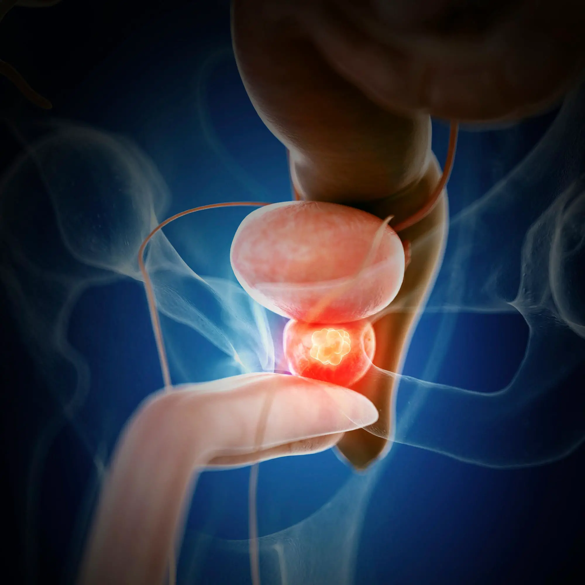 Revolutionary Prostate Cancer Treatment Kills Resistant Cells by Targeting Key Enzyme