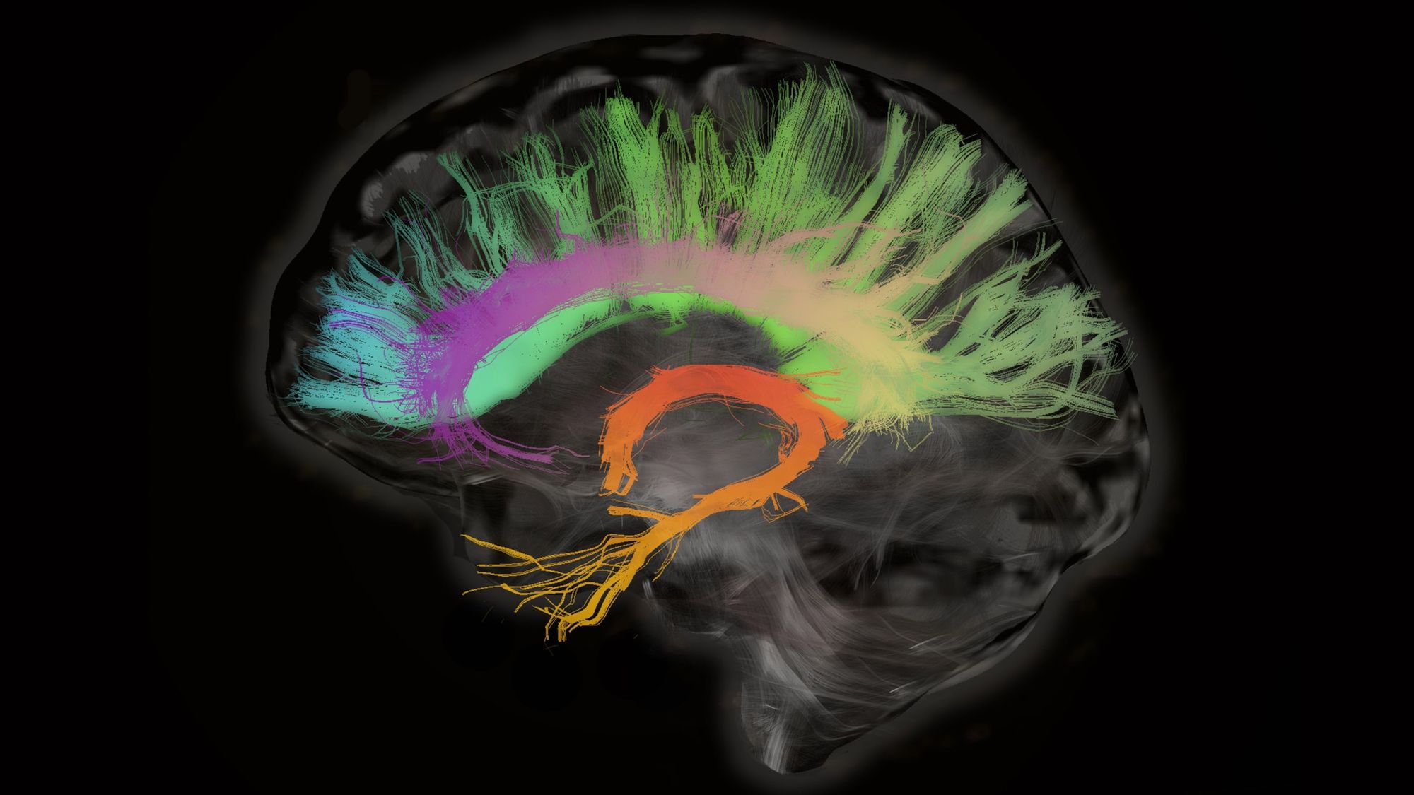 Brain stimulation can improve the memory of older people | MIT Technology Review