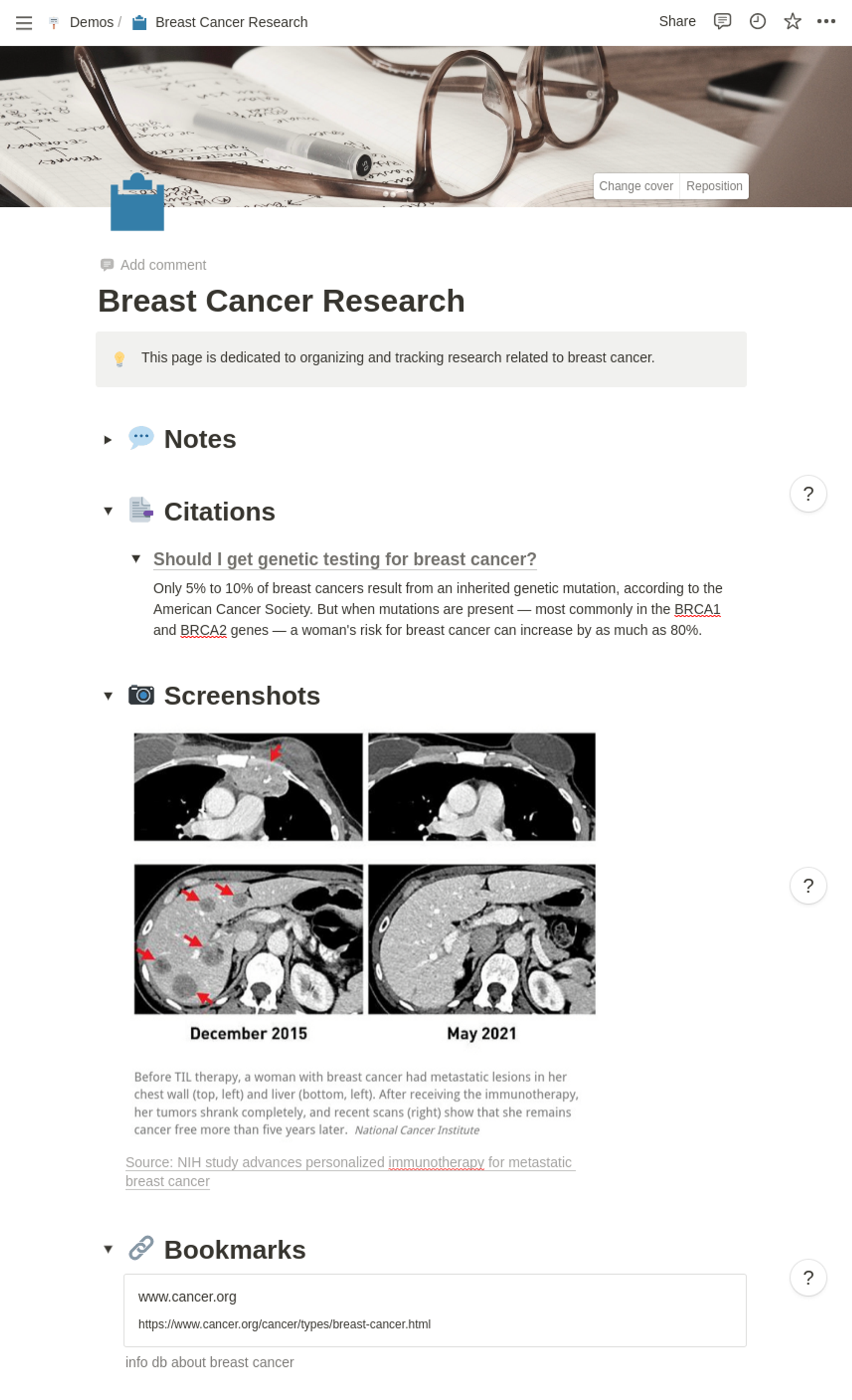 Capture of “Breast Cancer Research”  Notion page example
