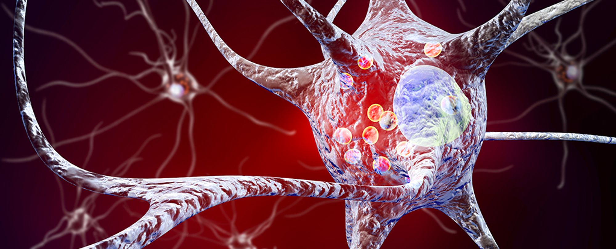 Parkinson's Drug Reduces Disease Markers in Breakthrough Trial